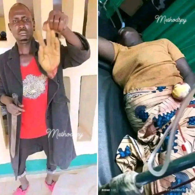 OMG!! Police Officer in Jos Allegedly Cuts Off Wife’s Hand Over Dispute