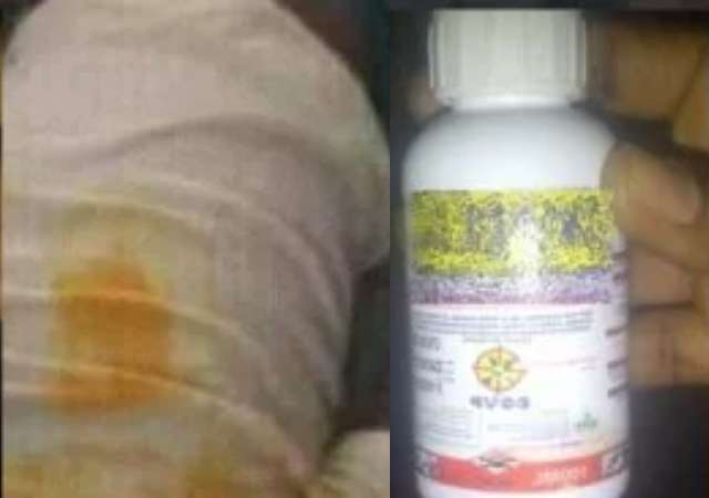 17-Year-Old Boy Allegedly Consumes Sn!Pper After His Boss Accused Him of Th!Eft