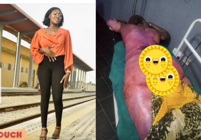 Nigerian Lady D!Es After Friends Pushed Her Into Pot of Boiling Stew (GRAPHIC PHOTOS)