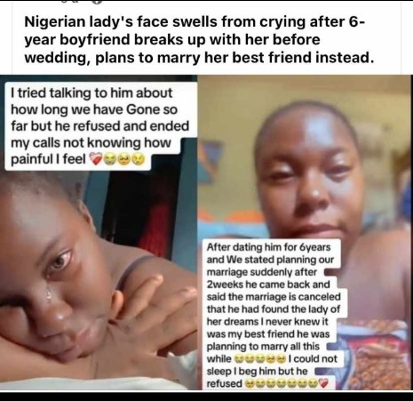 Nigerian Lady’s Face Swells After Relationship of 6 Years Ended (Photo)