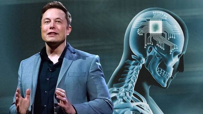 WOW!! Elon Musk’s Brain Chip That Can Help Blind People See Gets Approval